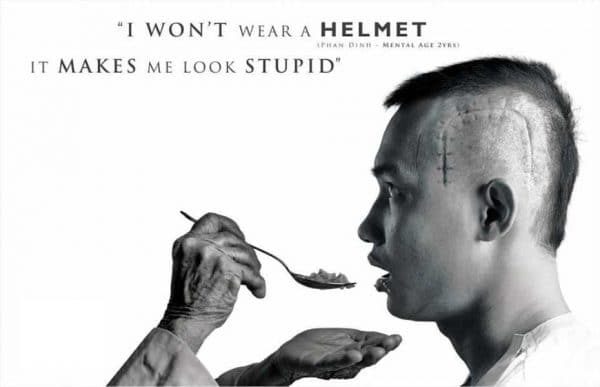 Wearing a helmet is a slight inconvenience in order to ensure you live a fuller life.